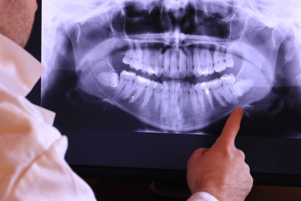 Best Emergency Treatment for Toothache in Walkerton, IN