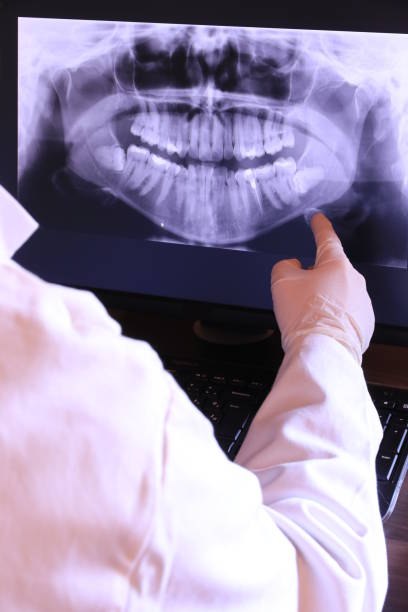 Best Emergency Tooth Extraction in Walkerton, IN