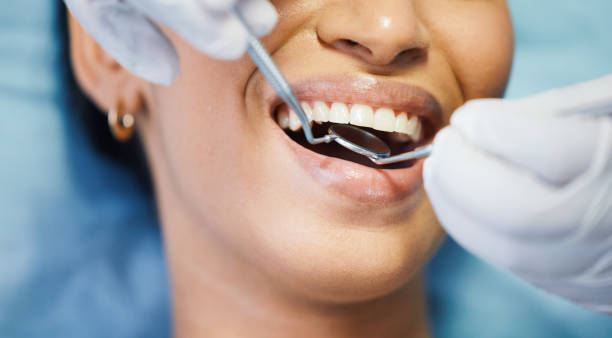 Best Emergency Wisdom Teeth Removal in Walkerton, IN